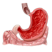 Barrett's Esophagus related image